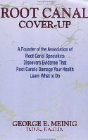 Root Canal Cover Up
